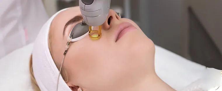 LASER NDYAG (Q-SWITCHED) - COLORMAX