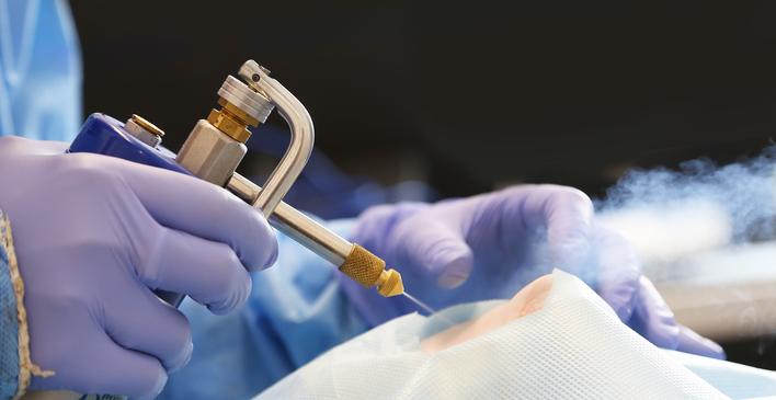 Crioterapia / Criocirugía